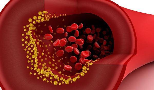 Η ουσία που μπορεί να προστατεύσει τις αρτηρίες μας από την αθηροσκλήρωση.