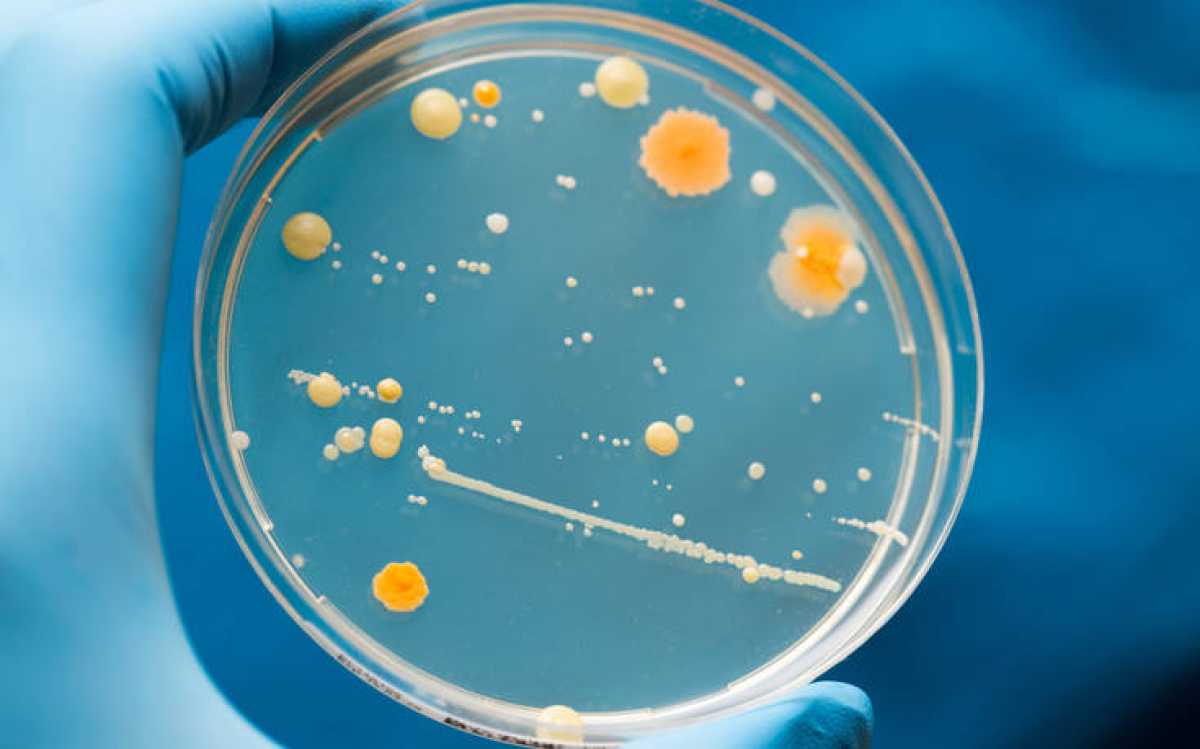 &Epsilon;&iota;&delta;&iota;&kappa;&omicron;ί &alpha;&nu;&eta;&sigma;&upsilon;&chi;&omicron;ύ&nu; &gamma;&iota;&alpha; &theta;&alpha;&nu;&alpha;&tau;&eta;&phi;ό&rho;&omicron; &mu;ύ&kappa;&eta;&tau;&alpha; &pi;&omicron;&upsilon; &epsilon;&xi;&alpha;&pi;&lambda;ώ&nu;&epsilon;&tau;&alpha;&iota; &pi;&alpha;&gamma;&kappa;&omicron;&sigma;&mu;ί&omega;&sigmaf;