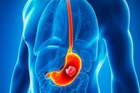 &Kappa;&alpha;&rho;&kappa;ί&nu;&omicron;&sigmaf; &tau;&omicron;&upsilon; &sigma;&tau;&omicron;&mu;ά&chi;&omicron;&upsilon;: &tau;&alpha; &pi;&rho;ώ&iota;&mu;&alpha; &sigma;&eta;&mu;ά&delta;&iota;&alpha; &tau;&omicron;&upsilon; &pi;&omicron;&upsilon; &delta;&epsilon;&nu; &pi;&rho;έ&pi;&epsilon;&iota; &nu;&alpha; &sigma;&upsilon;&gamma;&chi;έ&omicron;&nu;&tau;&alpha;&iota;!