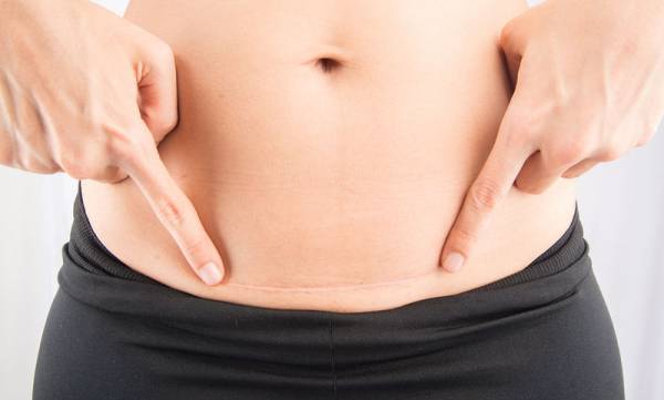 Έ&rho;&epsilon;&upsilon;&nu;&alpha; &sigma;&chi;&epsilon;&tau;ί&zeta;&epsilon;&iota; &tau;&eta;&nu; &kappa;&alpha;&iota;&sigma;&alpha;&rho;&iota;&kappa;ή &mu;&epsilon; &tau;&alpha; &epsilon;&nu;&delta;&epsilon;&chi;ό&mu;&epsilon;&nu;&alpha; &pi;&alpha;&chi;&upsilon;&sigma;&alpha;&rho;&kappa;ί&alpha;&sigmaf; &kappa;&alpha;&iota; ά&sigma;&theta;&mu;&alpha;&tau;&omicron;&sigmaf;