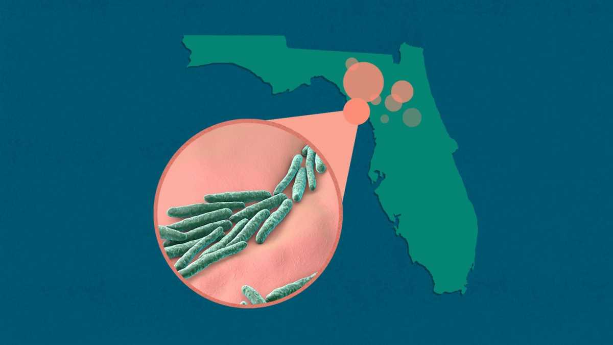 &Phi;&lambda;ό&rho;&iota;&nu;&tau;&alpha;: &Eta; &lambda;έ&pi;&rho;&alpha; &epsilon;&pi;&alpha;&nu;&epsilon;&mu;&phi;&alpha;&nu;ί&sigma;&tau;&eta;&kappa;&epsilon; &kappa;&alpha;&iota; &mu;&pi;&omicron;&rho;&epsilon;ί &nu;&alpha; &gamma;ί&nu;&epsilon;&iota; &epsilon;&nu;&delta;&eta;&mu;&iota;&kappa;ή