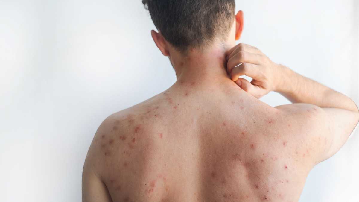 &Iota;&lambda;&alpha;&rho;ά &sigma;&tau;&eta;&nu; &Epsilon;&upsilon;&rho;ώ&pi;&eta;: H &nu;ό&sigma;&omicron;&sigmaf; &epsilon;ί&nu;&alpha;&iota; &epsilon;&nu;&epsilon;&rho;&gamma;ή