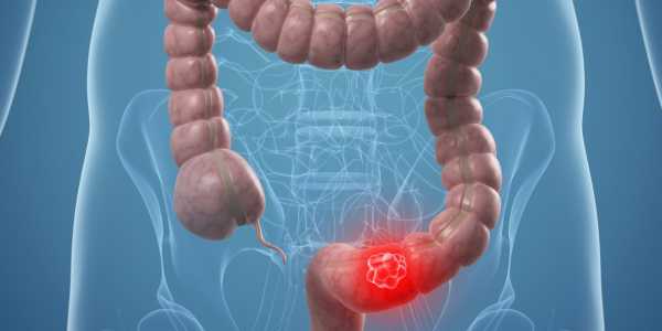 &Nu;έ&alpha; έ&rho;&epsilon;&upsilon;&nu;&alpha; &rho;ί&chi;&nu;&epsilon;&iota; &pi;&epsilon;&rho;&iota;&sigma;&sigma;ό&tau;&epsilon;&rho;&omicron; &phi;&omega;&sigmaf; &sigma;&tau;&omicron; &gamma;&epsilon;&nu;&epsilon;&tau;&iota;&kappa;ό &pi;&rho;&omicron;&phi;ί&lambda; &tau;&omicron;&upsilon; &kappa;&alpha;&rho;&kappa;ί&nu;&omicron;&upsilon; &pi;&alpha;&chi;έ&omicron;&sigmaf; &epsilon;&nu;&tau;έ&rho;&omicron;&upsilon;