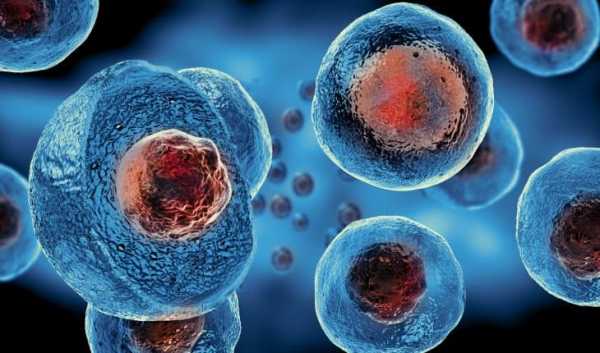 Ασθενής με AIDS θεραπεύτηκε πλήρως μετά από μεταμόσχευση βλαστοκυττάρων!